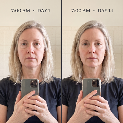 Same light, same time: 7:00 AM day 1 vs 7:00 AM day 14 morning face